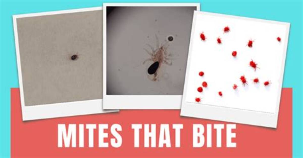 Could Mites Be Biting Me?