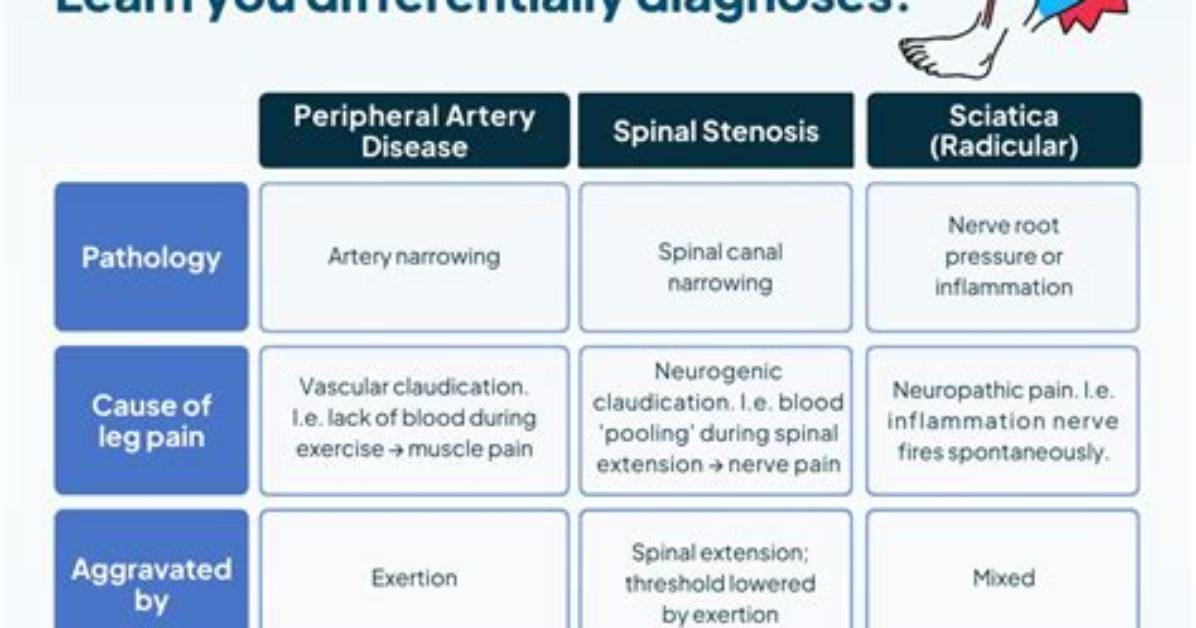 Could Sciatica Pain Be Something Else?