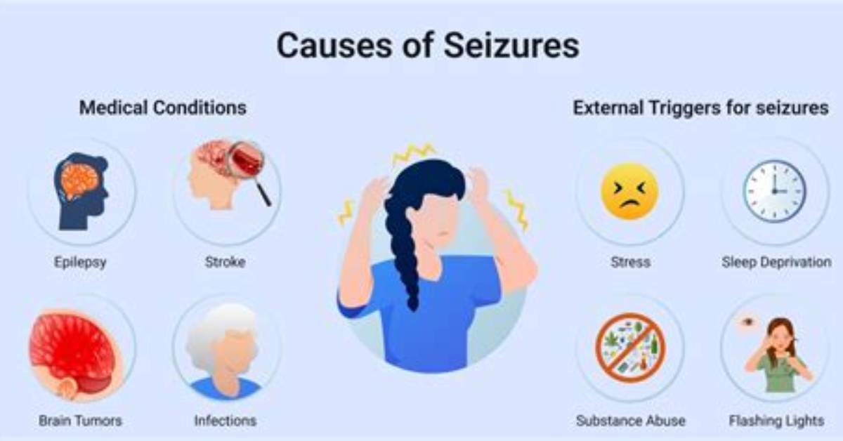 Could Seizures Cause Sleep?