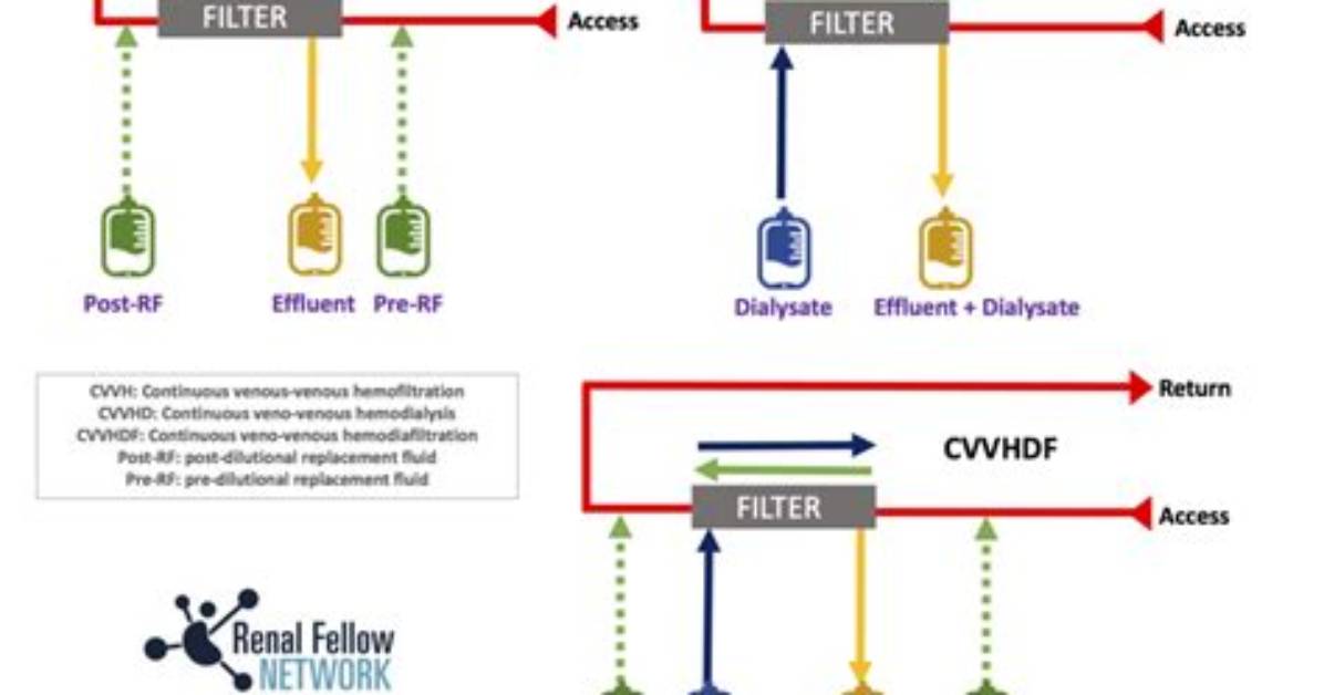 Cvvh vs Cvvhd