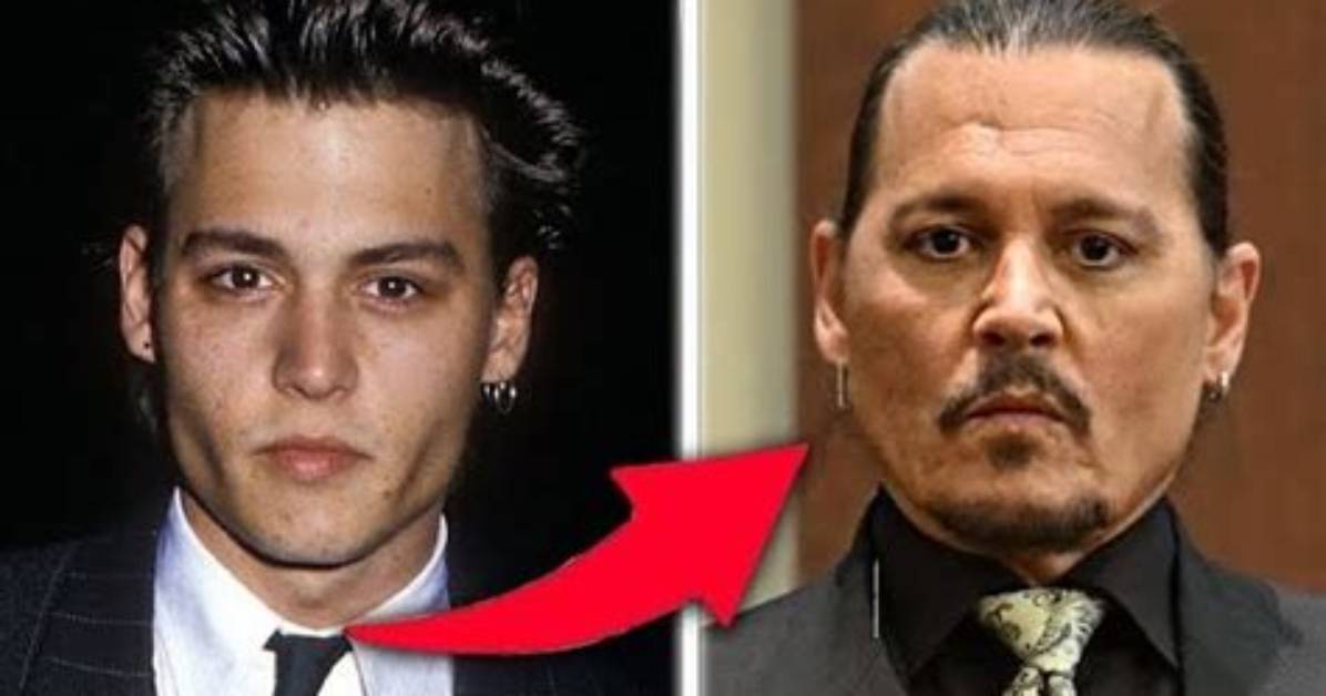 Decoding Johnny Depp's Plastic Surgery Debate
