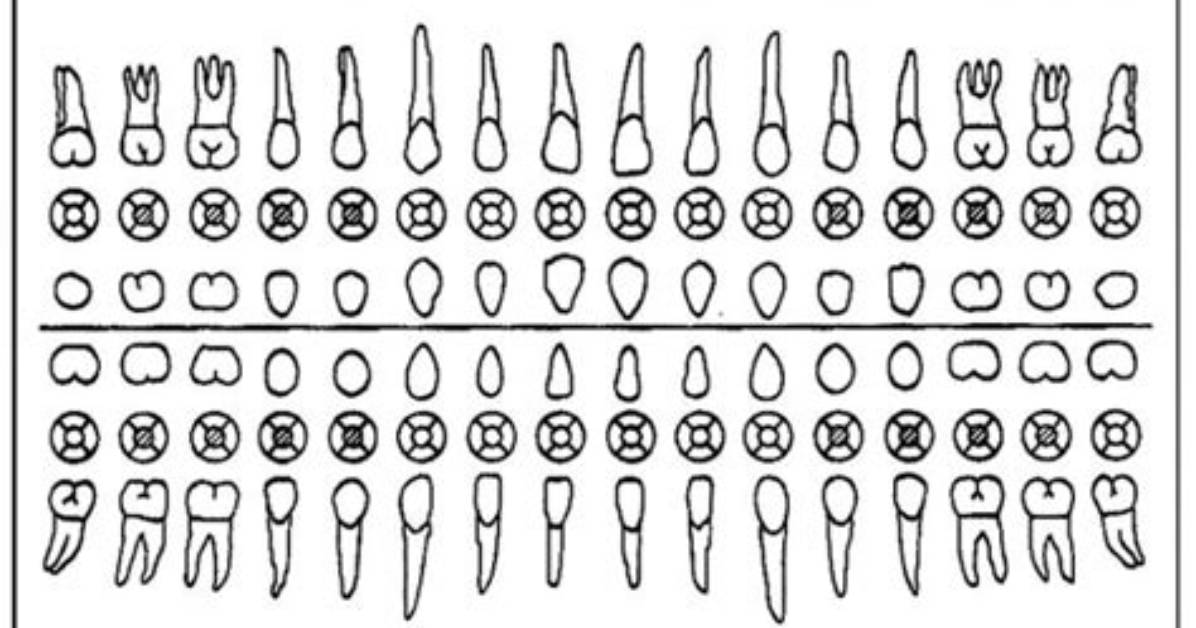 Dental Charting — Printable Worksheet