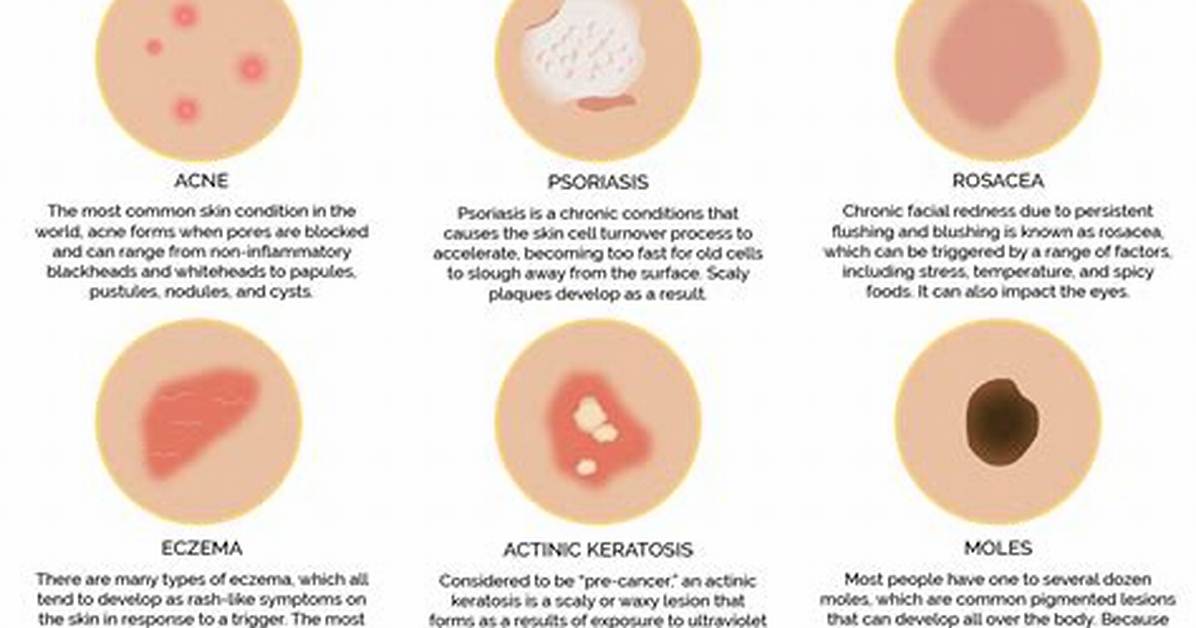 Dermatology