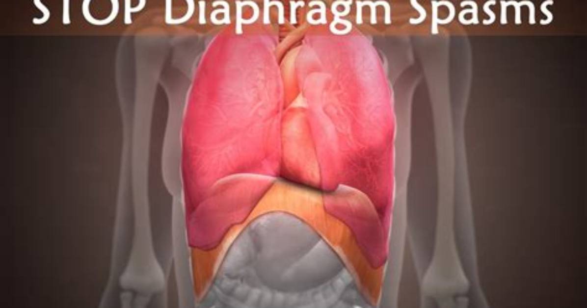 Diaphragm Spasm