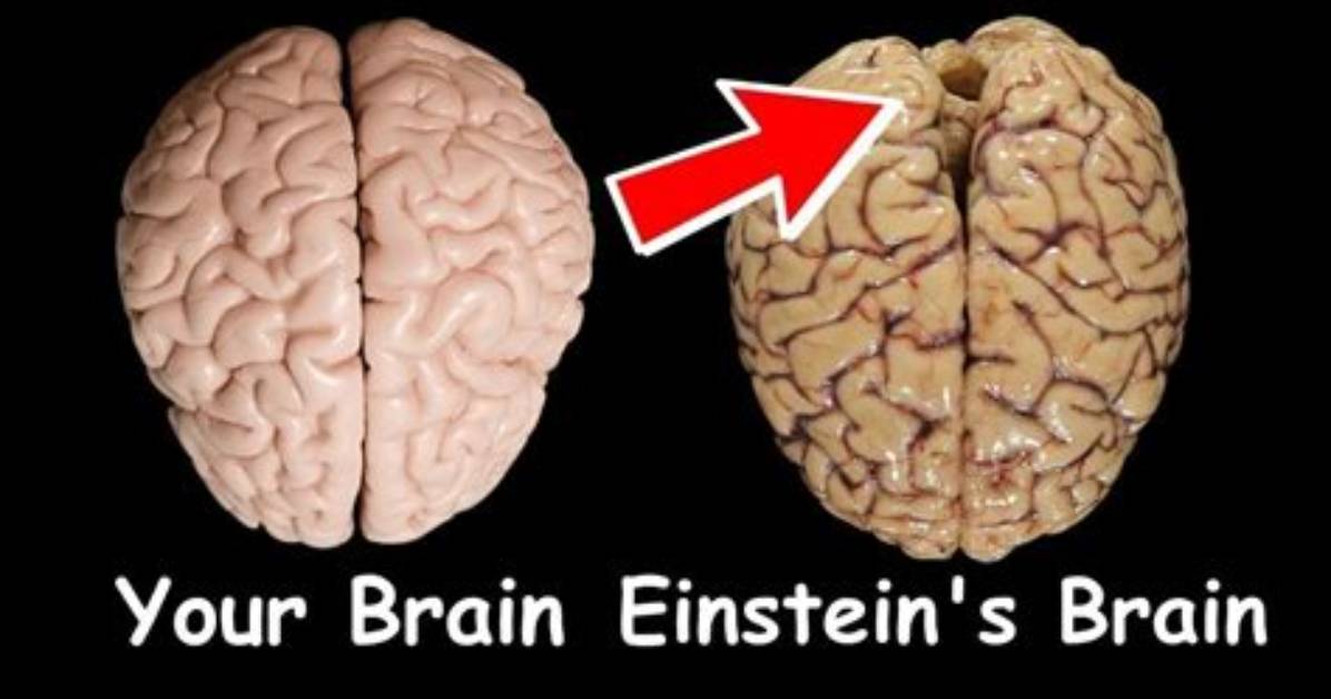 Did Einstein Have a Small Brain?
