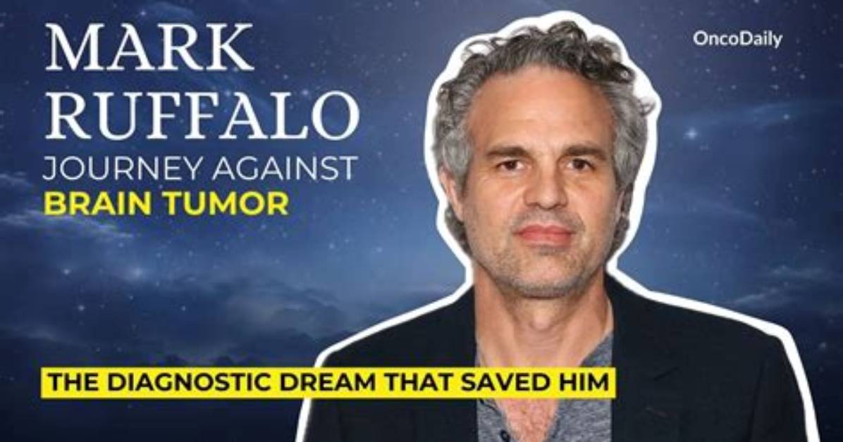 Did Mark Ruffalo Have a Brain Tumor? – Celebrity