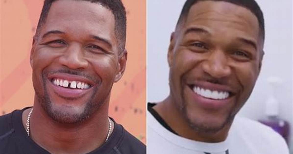Did Michael Strahan Close His Gap?