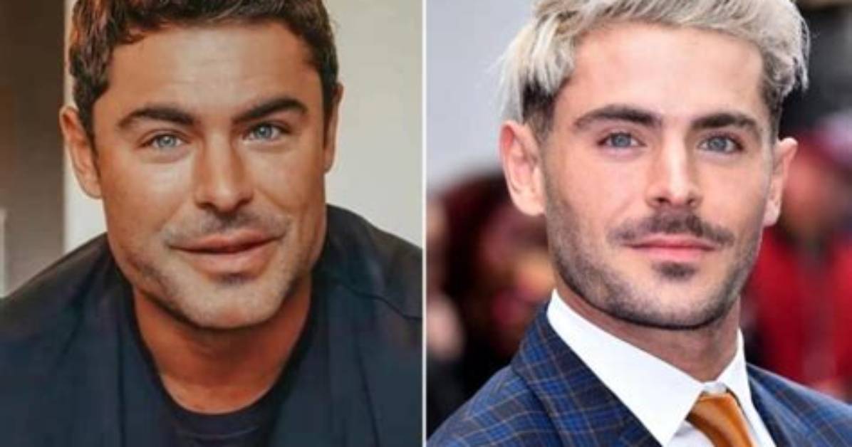 Did Zac Efron Have a Plastic Surgery? Face Accident, Before and After