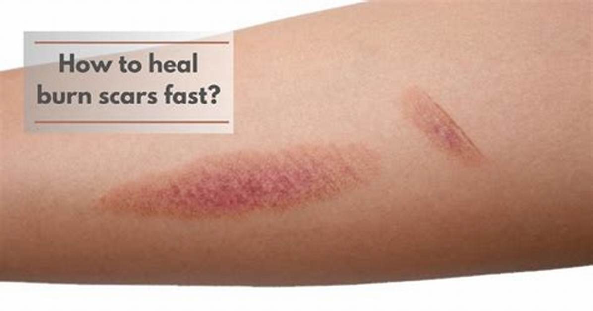 Do Abrasion Cause Scars?