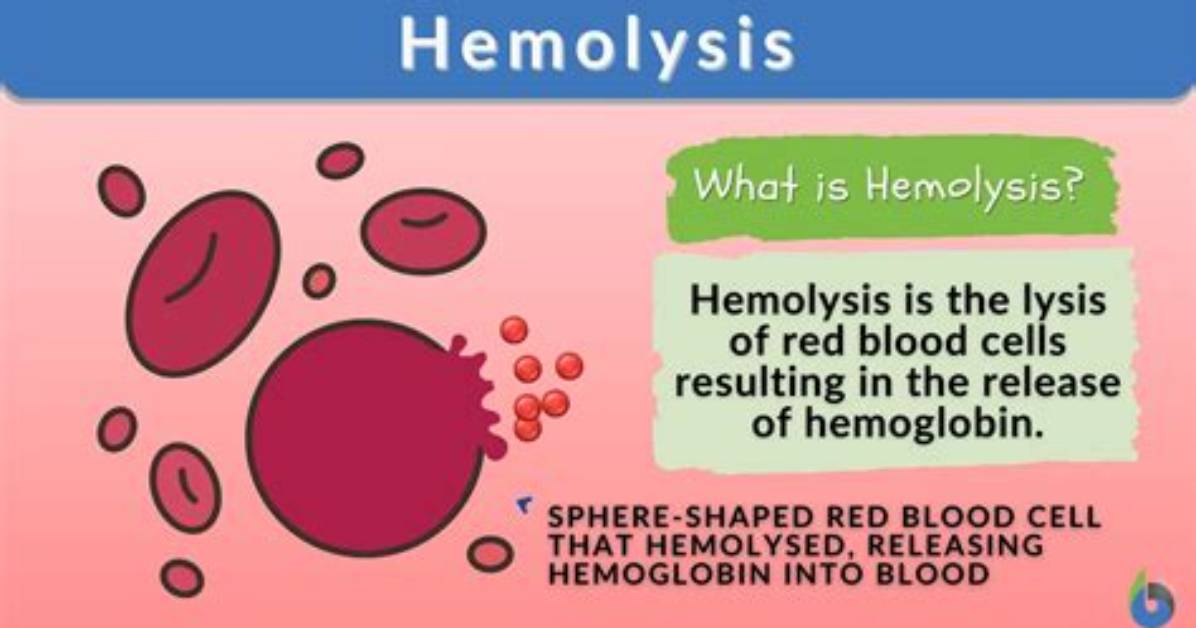 Do Alcohol Cause Hemolysis?