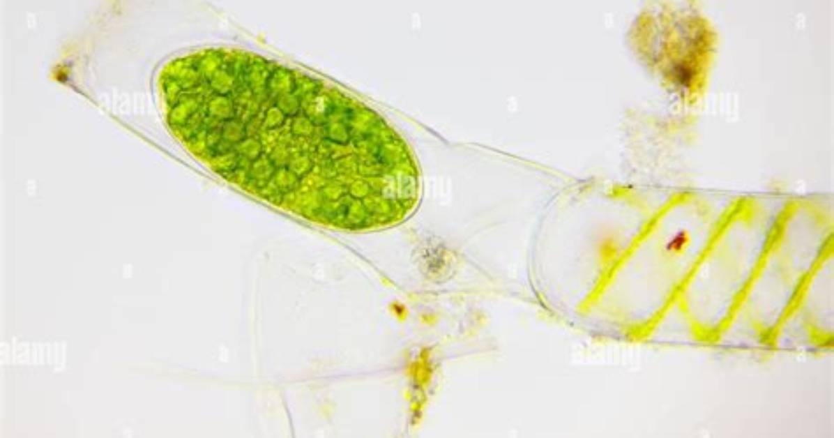 Do Algae Have Filament