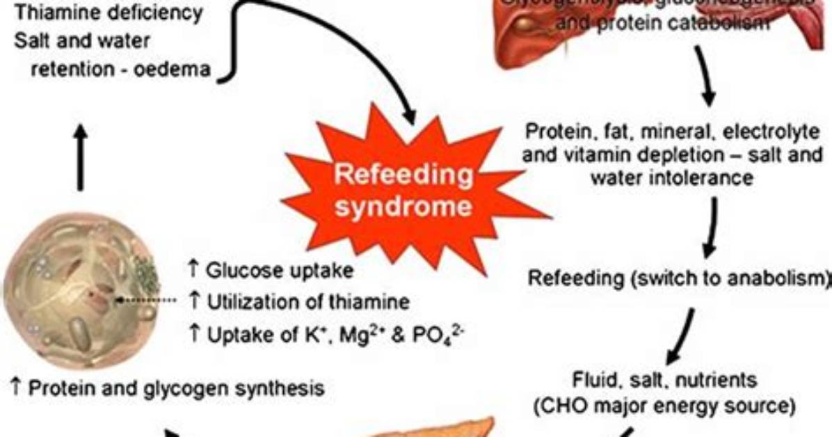 Do Animals Get Refeeding Syndrome?