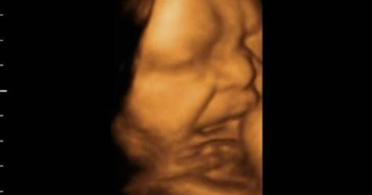 Do Babies Cry in Utero?