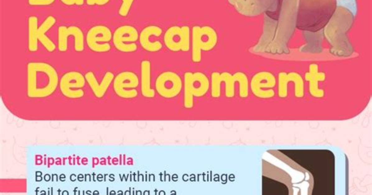 Do Babies Have Kneecaps?