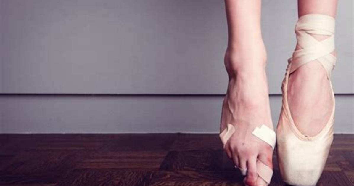 Do Ballerinas Toenails Fall off?