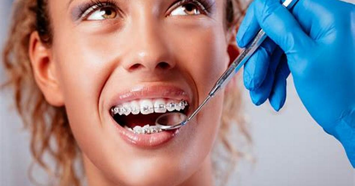Do Braces Widen Your Smile?