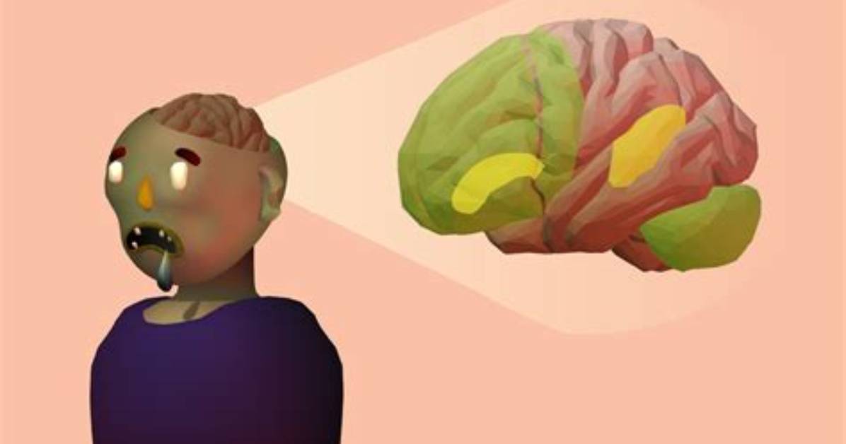 Do Brains Have Zombies?