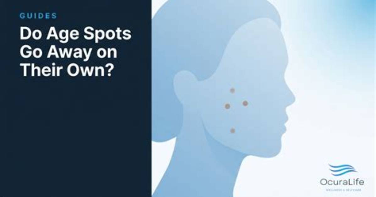 Do Brown Spots Go Away?