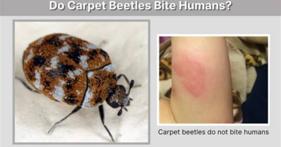 Do Burying Beetles Bite?