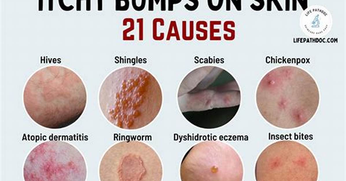 Do Chafing Bumps Itch?