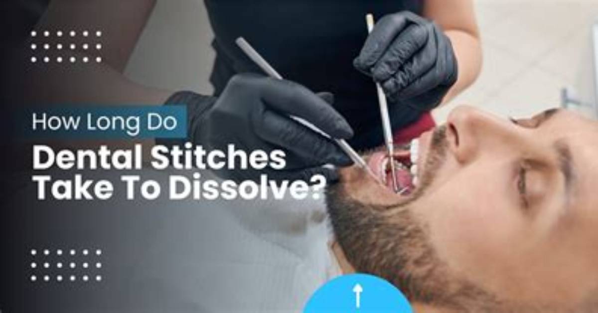 Do Dental Stitches Dissolve?