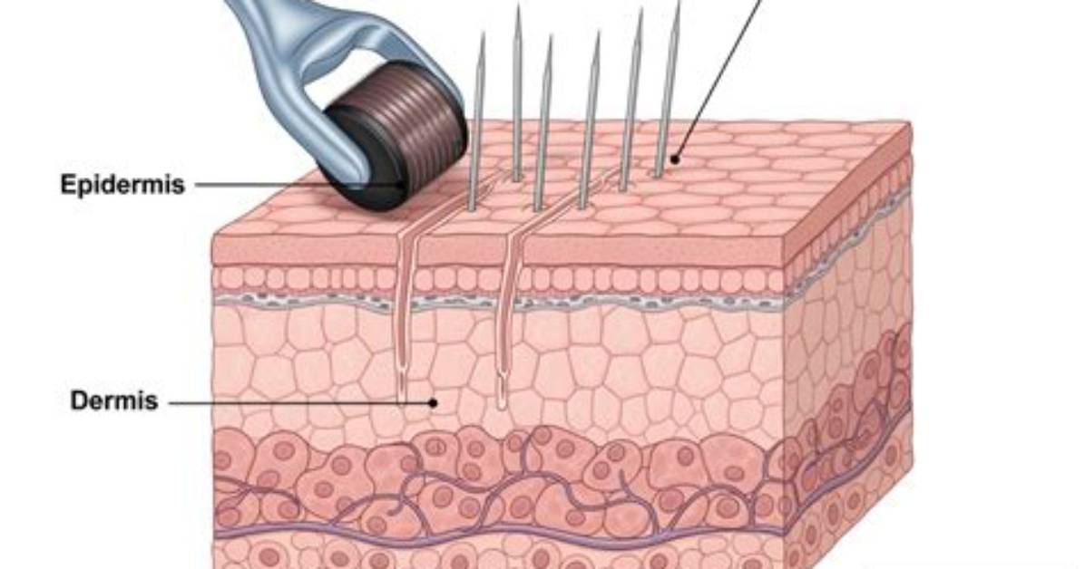 Do Derma Wands Work?