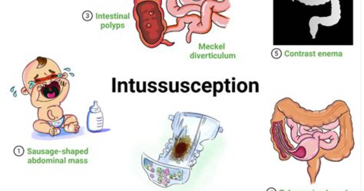Do Dogs Get Intussusception?