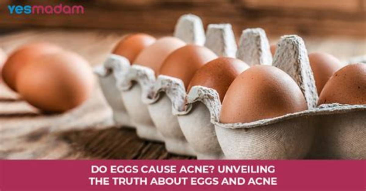 Do Eggs Cause Acne?