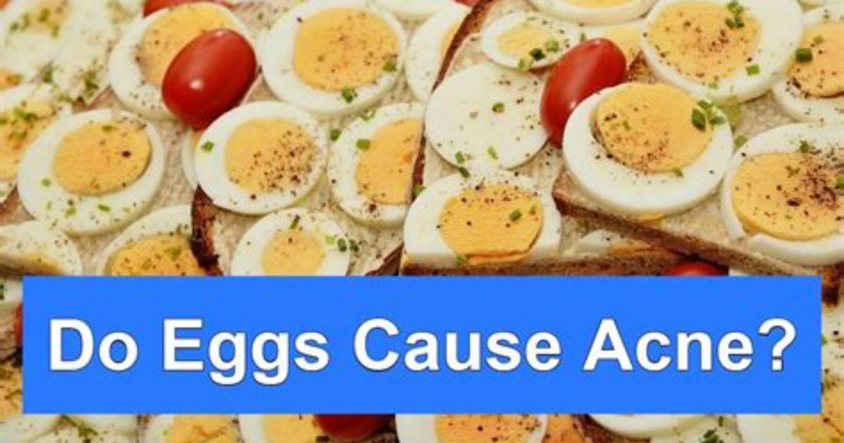 Do Eggs Give You Acne?