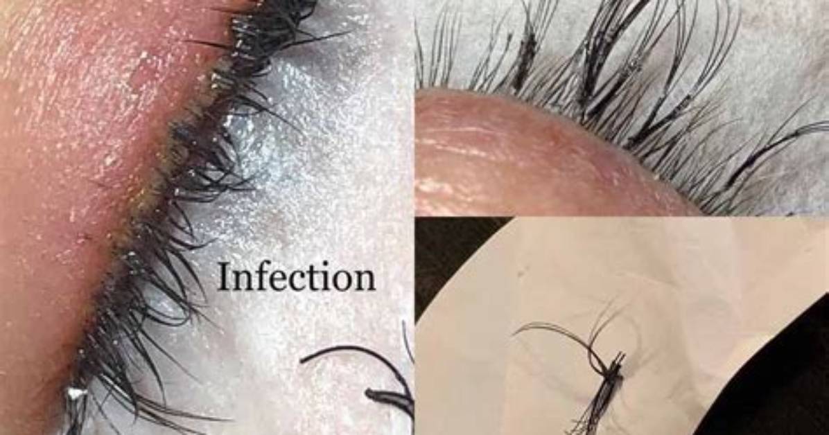 Do Eyelash Extensions Hurt?