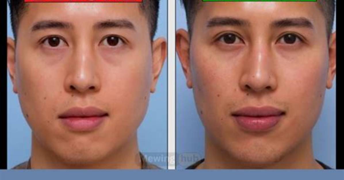 Do False Teeth Change Your Face?