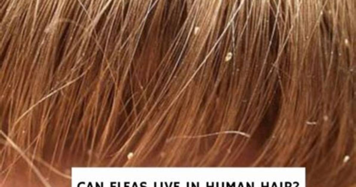 Do Fleas Live in Human Hair?