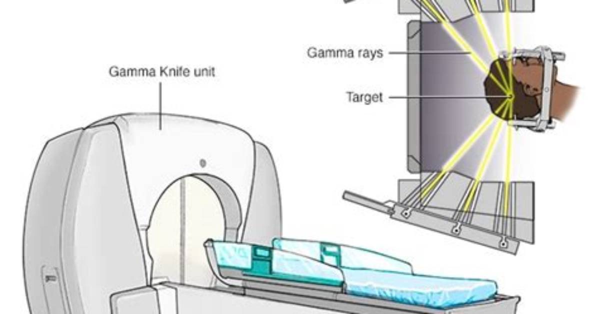 Do Gamma Rays Cause Cancer?