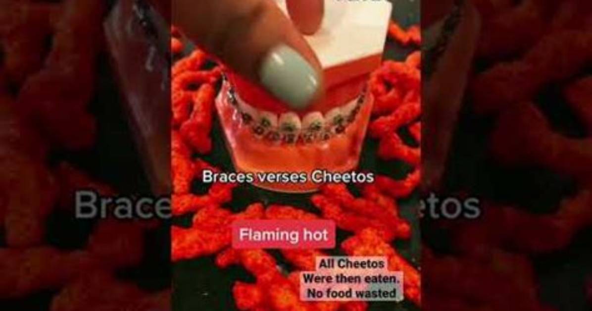 Do Hot Cheetos Stain Your Clothes