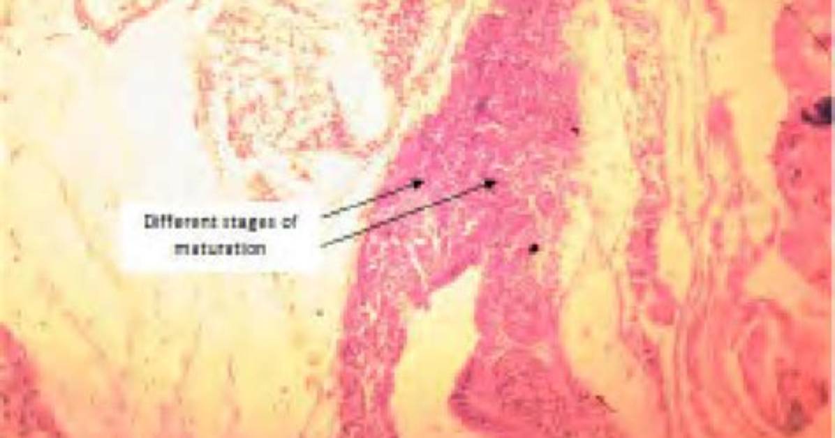 Do Humans Have Preputial Glands?