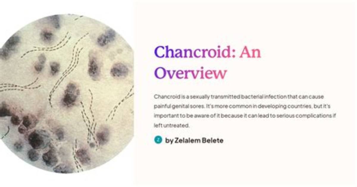 Do I Have Chancroid?