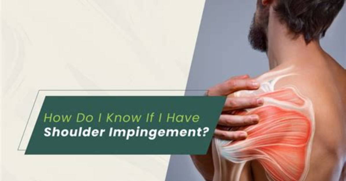 Do I Have Impingement?