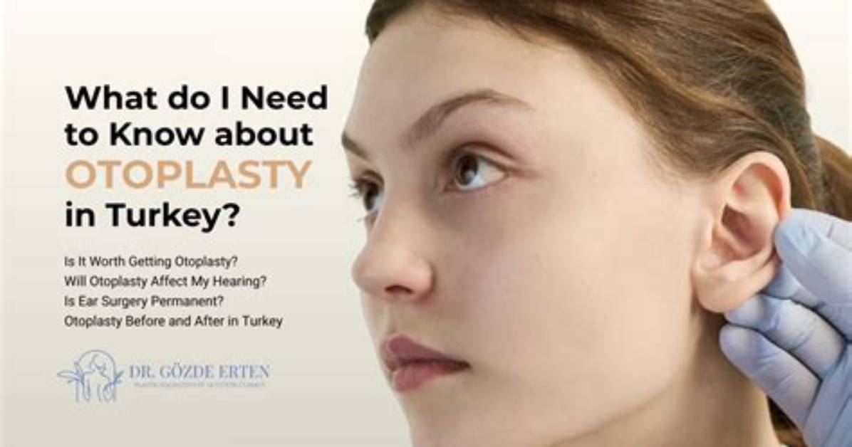 Do I Need Otoplasty?