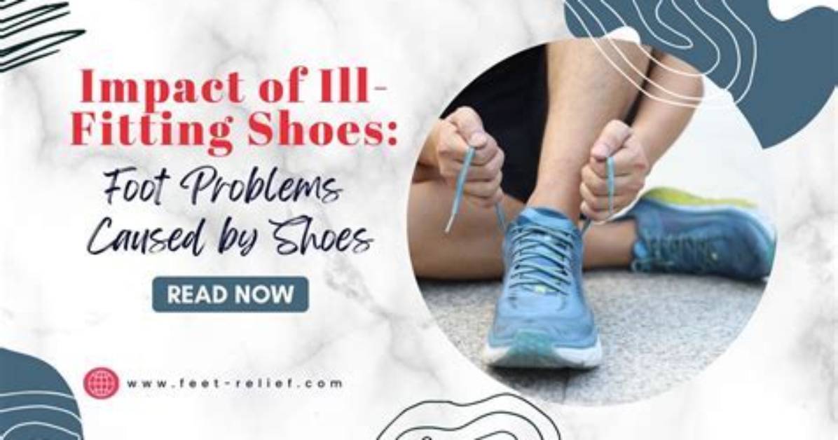Do Ill Fitting Shoes Cause Bunions?