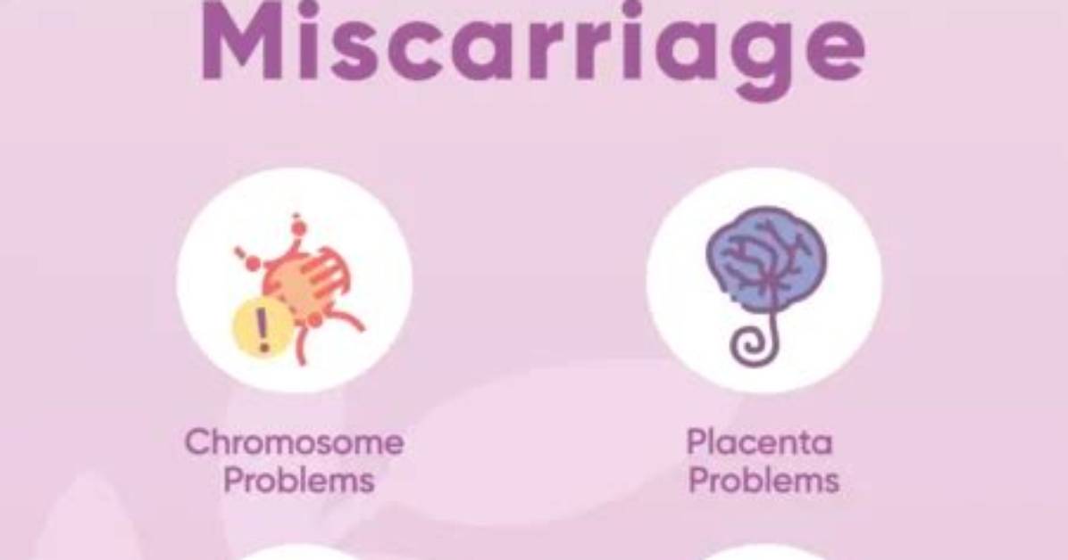Do Miscarriages Happen Suddenly?