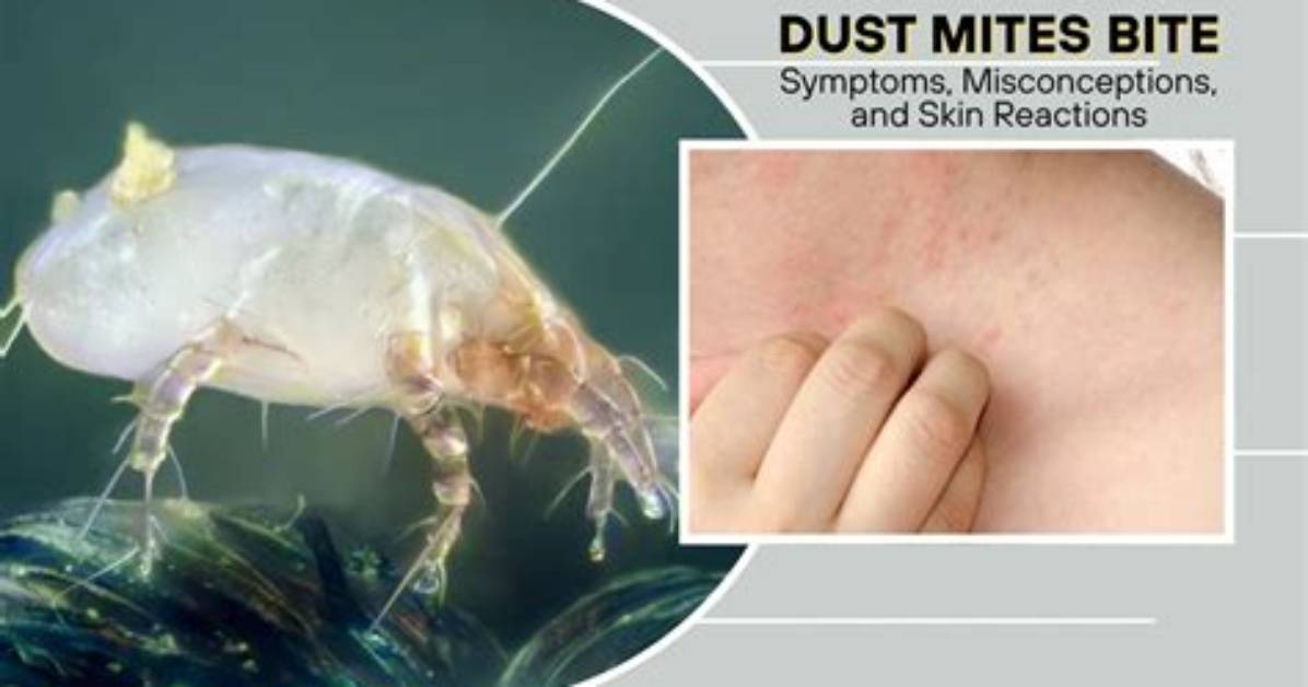 Do Mites Bite at Night?
