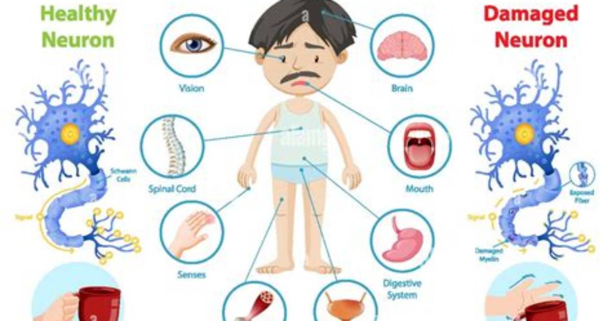 Do Ms Symptoms Come Go