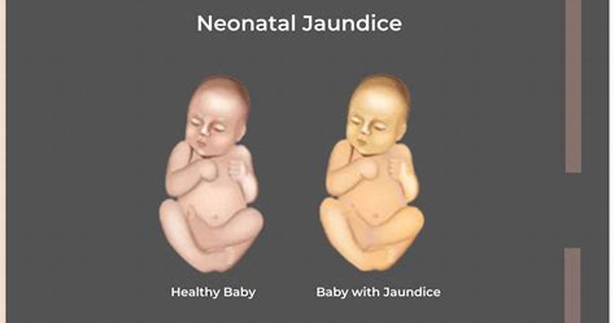 Do Newborns Have Immunities?
