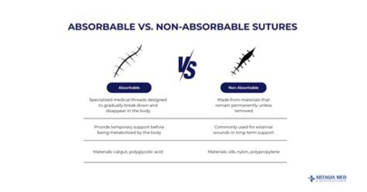 Do Non Absorbable Sutures Dissolve?