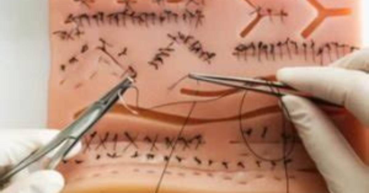 Do Nurses Learn to Suture?