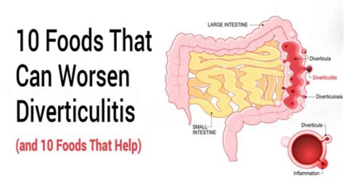 Do Nuts Aggravate Diverticulitis?
