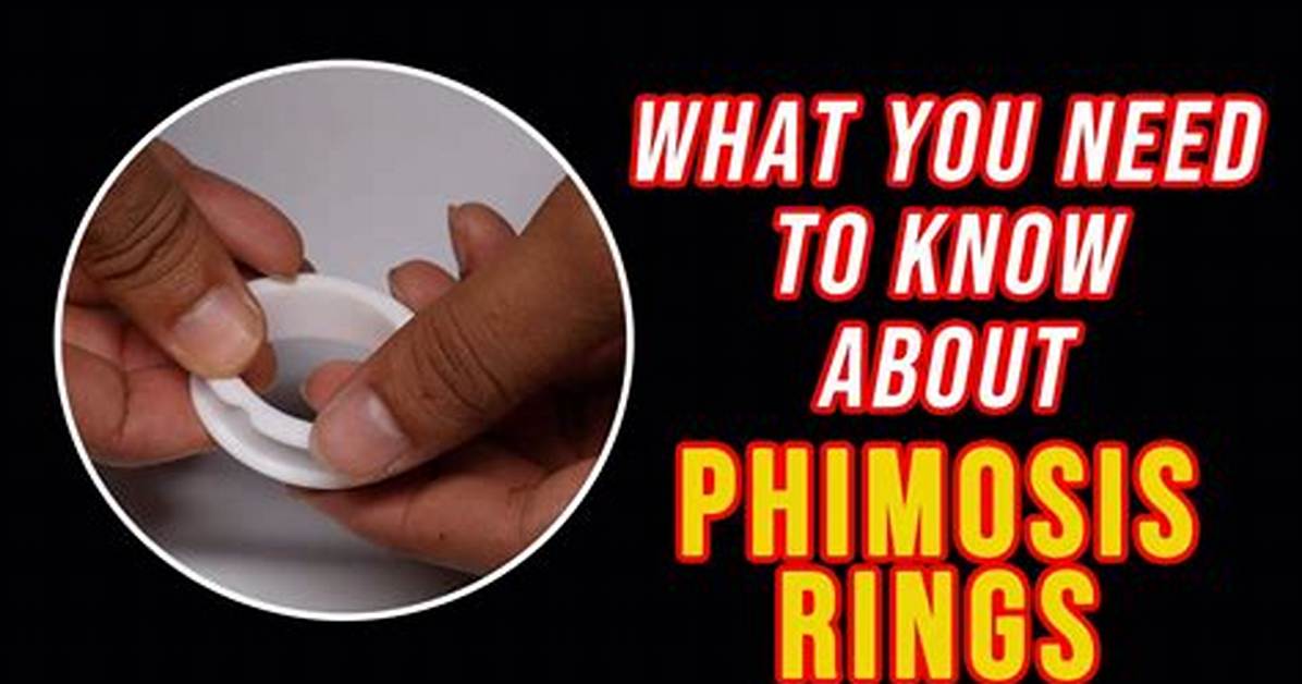 Do Phimosis Rings Work?