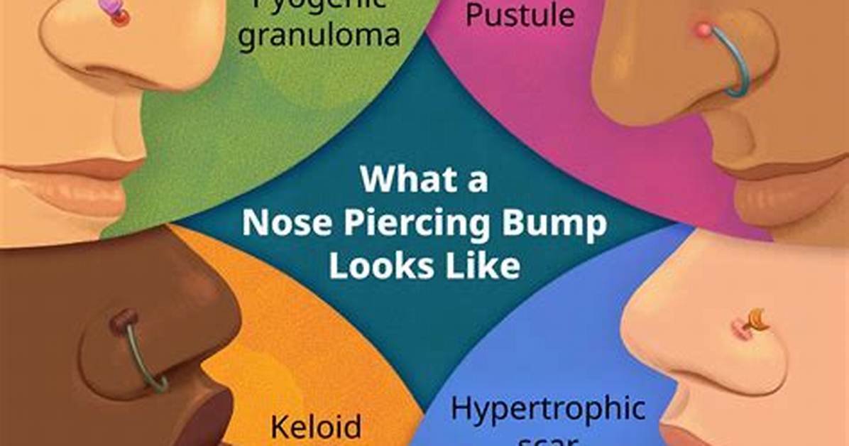 Do Piercing Bumps Hurt