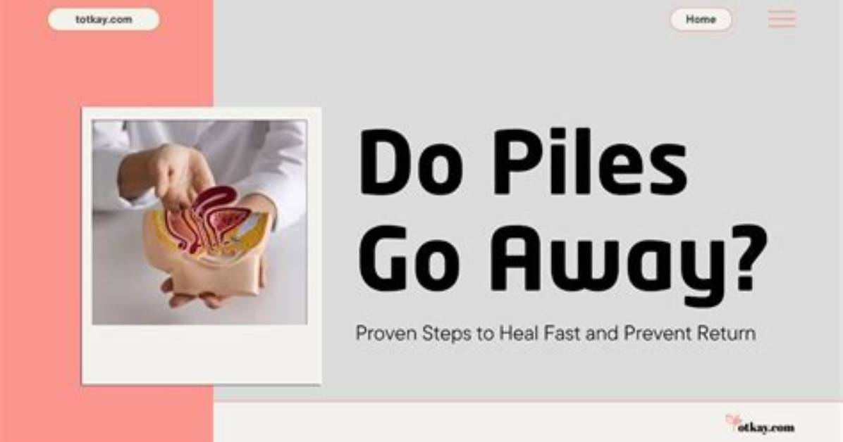 Do Piles Go Away?