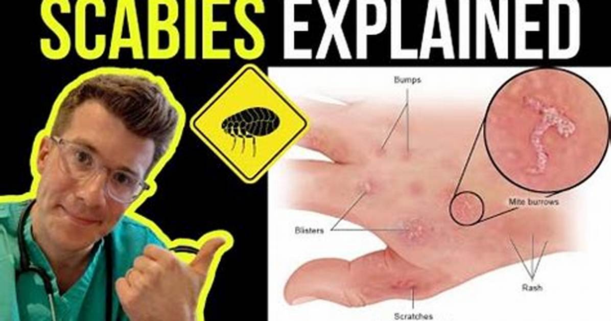 Do Scabies Look Like Worms?